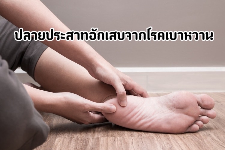 โรคเส้นประสาทจากโรคเบาหวาน  diabetic polyneuropathy