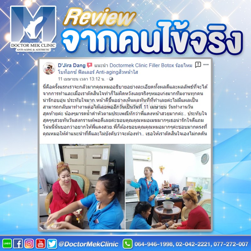 รีวิวฟิลเลอร์หน้าเด็ก