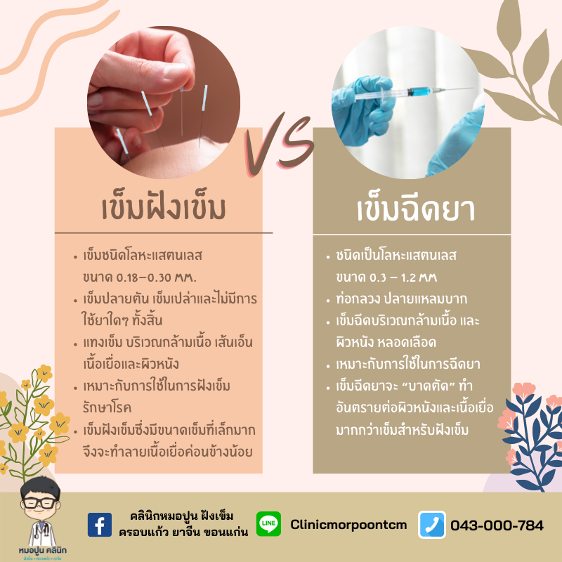 เข็มฝังเข็ม vs เข็มฉีดยา